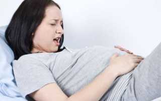 Рези внизу живота при беременности