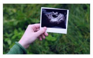 Тест положительный а узи беременность не показывает