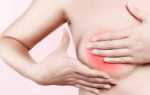 Как правильно расцедить грудь после родов