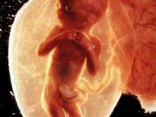 Плод ю в 5 месяцев беременности фото. 6 недель беременности фото плода. Плод 5 месяцев. Плод 5 месяцев. Ребёнок на 5 месяце беременности.